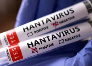 Primul caz de hantavirus confirmat în România. Pacient spitalizat la Arad, transferit din Bihor cu simptome. Primul caz de hantavirus confirmat în România. Pacient spitalizat la Arad, transferit din Bihor cu simptome.